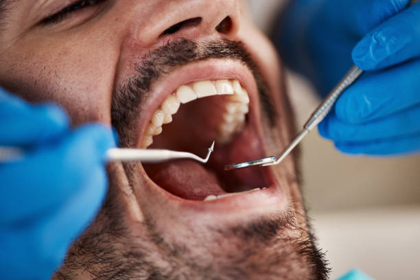 Best Dental Exams and Cleanings  in Blue Mountain, MS